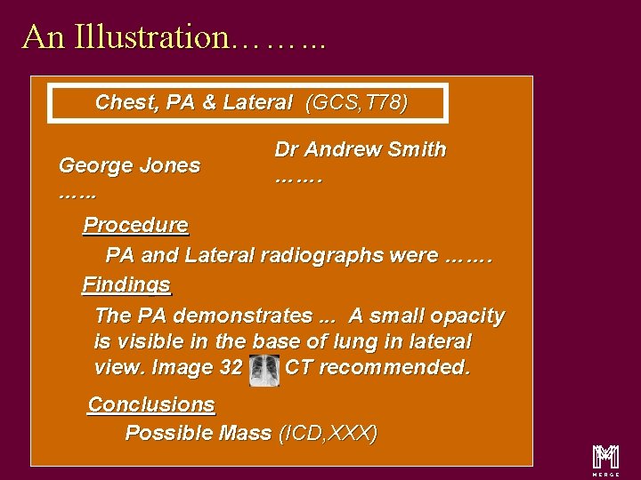 An Illustration……. . . Chest, PA & Lateral (GCS, T 78) George Jones ….