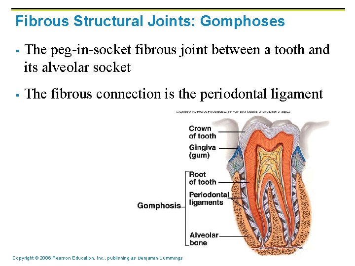 Fibrous Structural Joints: Gomphoses § § The peg-in-socket fibrous joint between a tooth and