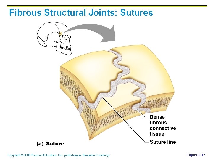 Fibrous Structural Joints: Sutures Copyright © 2006 Pearson Education, Inc. , publishing as Benjamin