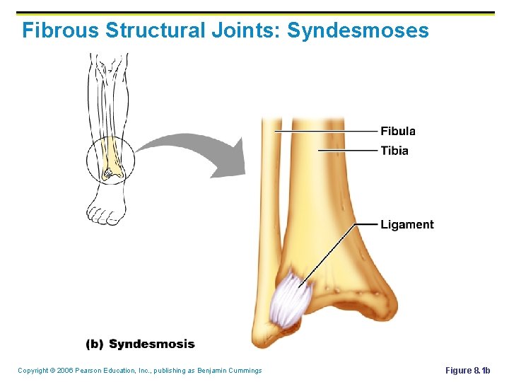 Fibrous Structural Joints: Syndesmoses Copyright © 2006 Pearson Education, Inc. , publishing as Benjamin