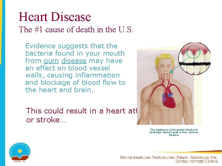Heart Disease The #1 cause of death in the U. S. Evidence suggests that