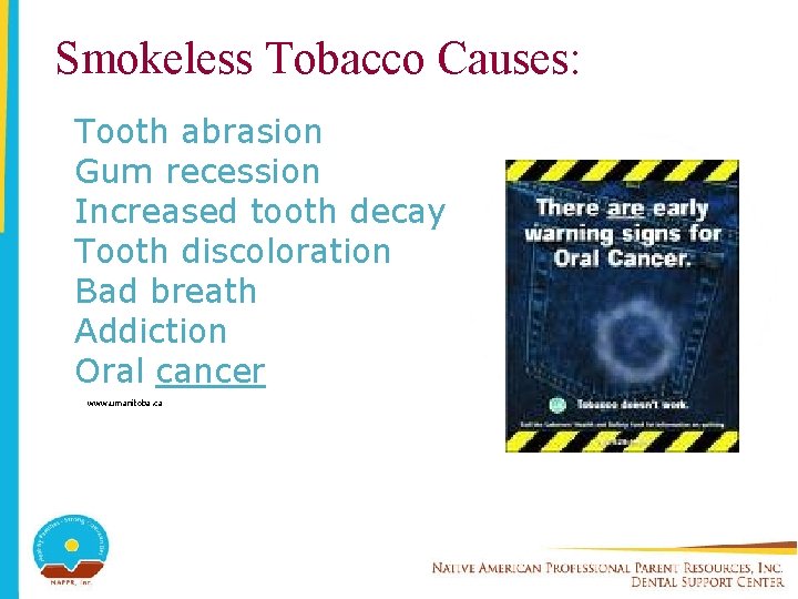 Smokeless Tobacco Causes: Tooth abrasion Gum recession Increased tooth decay Tooth discoloration Bad breath