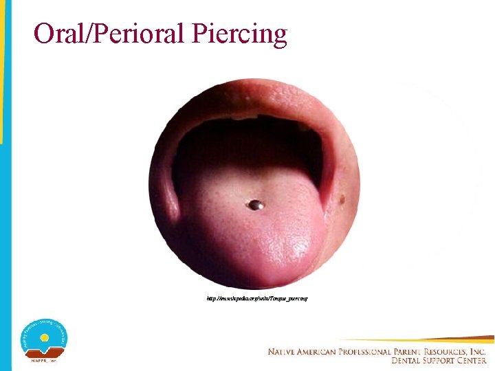 Oral/Perioral Piercing http: //en. wikipedia. org/wiki/Tongue_piercing 