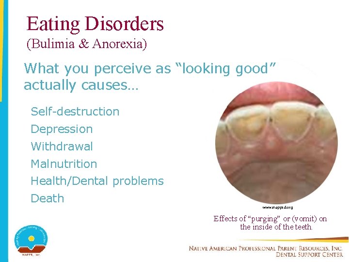 Eating Disorders (Bulimia & Anorexia) What you perceive as “looking good” actually causes… Self-destruction