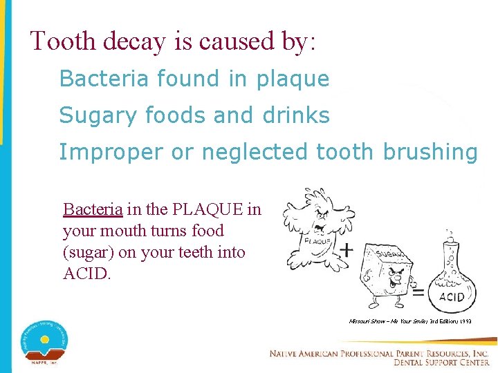 Tooth decay is caused by: Bacteria found in plaque Sugary foods and drinks Improper