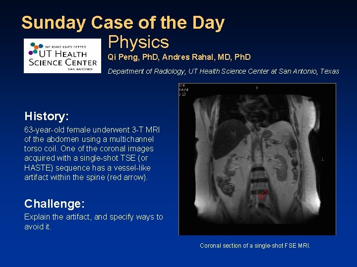 Sunday Case of the Day Physics Qi Peng, Ph. D, Andres Rahal, MD, Ph.