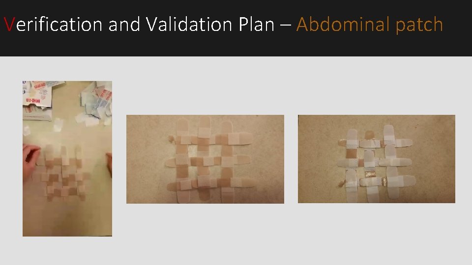 Verification and Validation Plan – Abdominal patch Verification and Validation Plan – Abdominal patch