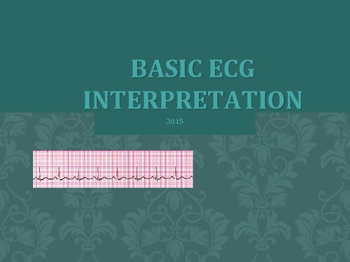 BASIC ECG INTERPRETATION 2015 