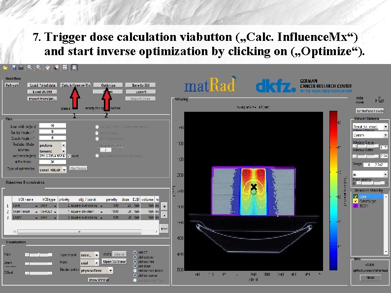 7. Trigger dose calculation viabutton („Calc. Influence. Mx“) and start inverse optimization by clicking