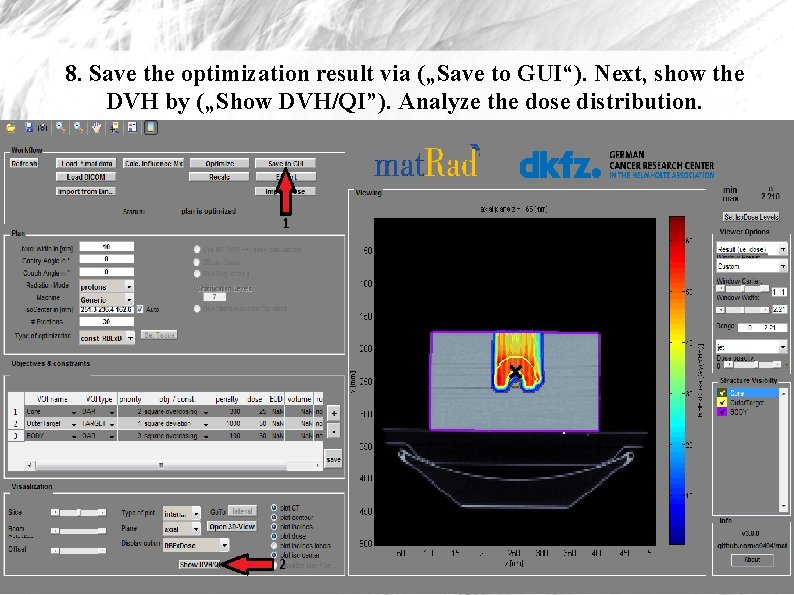 8. Save the optimization result via („Save to GUI“). Next, show the DVH by