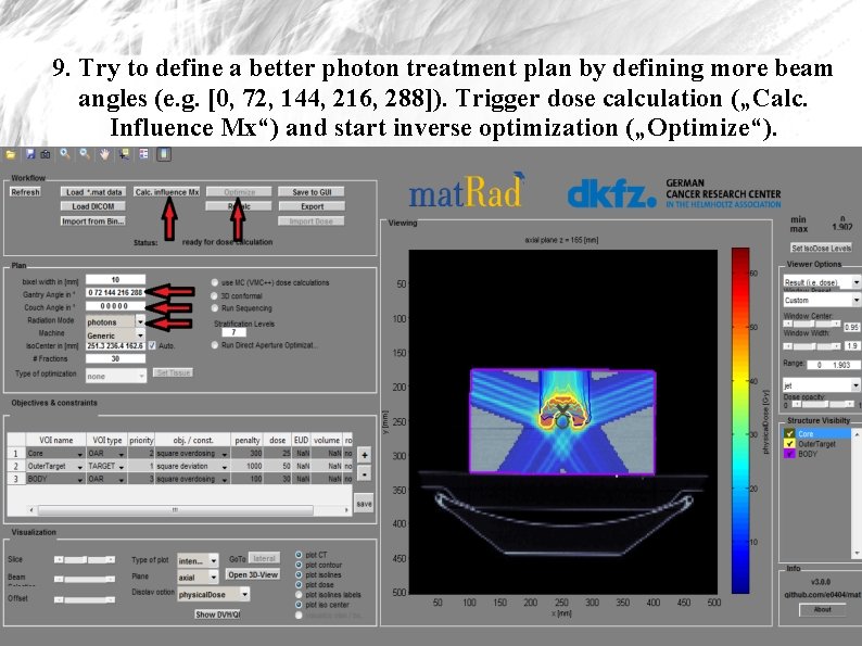9. Try to define a better photon treatment plan by defining more beam angles