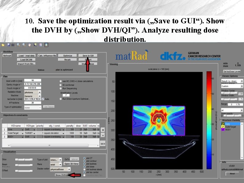 10. Save the optimization result via („Save to GUI“). Show the DVH by („Show