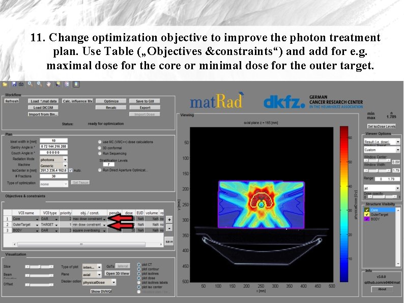 11. Change optimization objective to improve the photon treatment plan. Use Table („Objectives &constraints“)