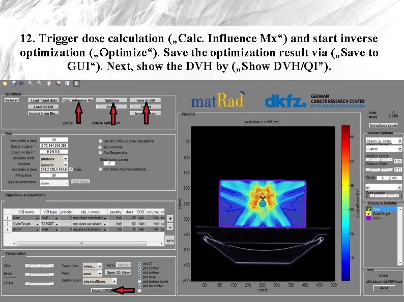 12. Trigger dose calculation („Calc. Influence Mx“) and start inverse optimization („Optimize“). Save the