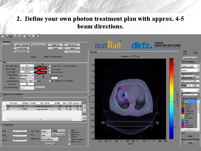 2. Define your own photon treatment plan with approx. 4 -5 beam directions. 