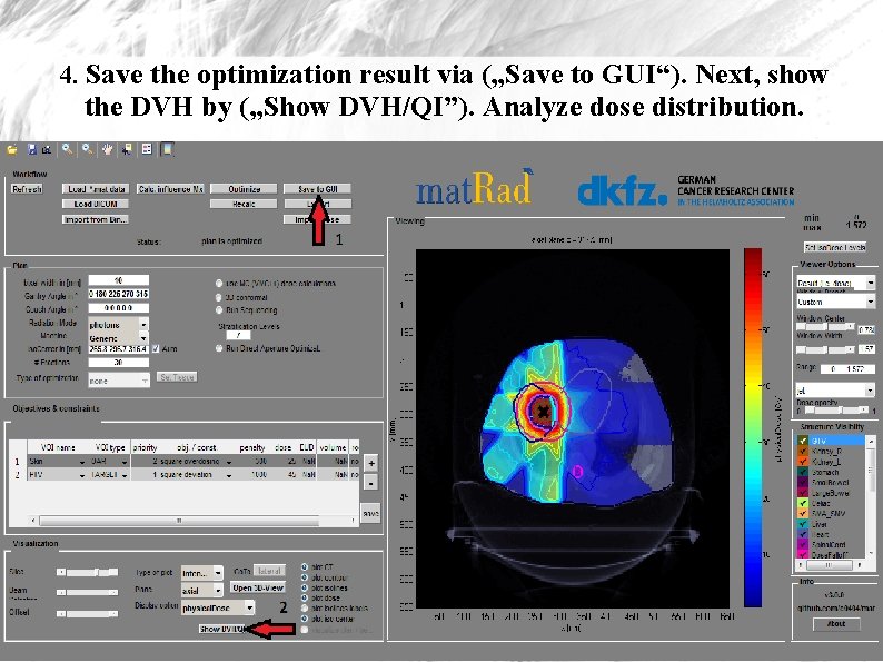 4. Save the optimization result via („Save to GUI“). Next, show the DVH by