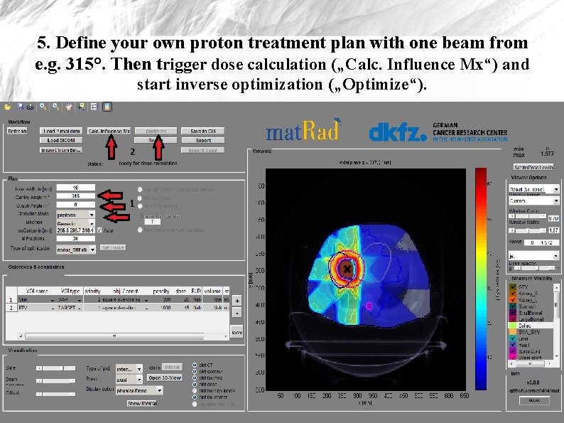 5. Define your own proton treatment plan with one beam from e. g. 315°.