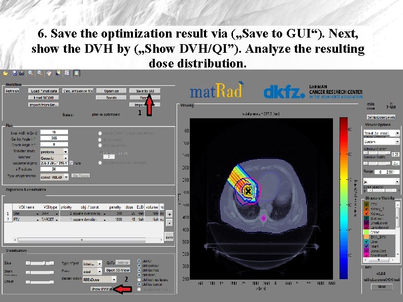 6. Save the optimization result via („Save to GUI“). Next, show the DVH by