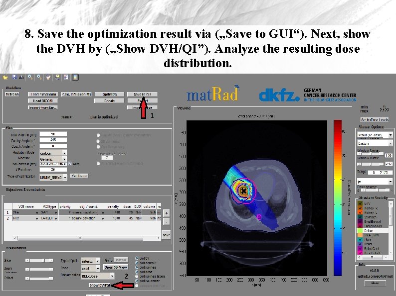 8. Save the optimization result via („Save to GUI“). Next, show the DVH by