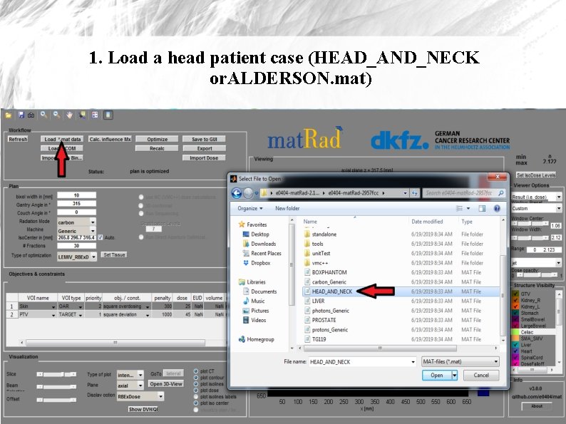 1. Load a head patient case (HEAD_AND_NECK or. ALDERSON. mat) 