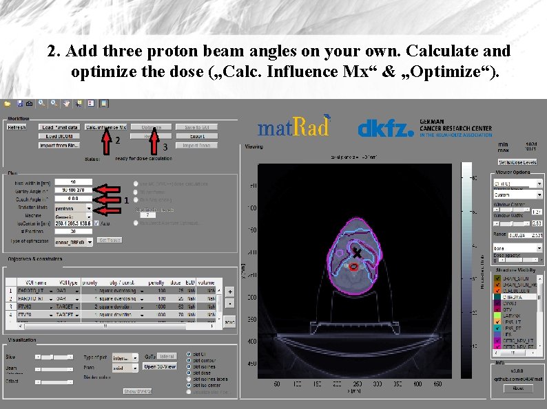 2. Add three proton beam angles on your own. Calculate and optimize the dose