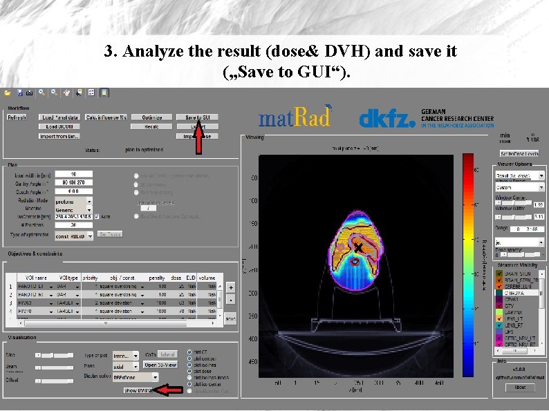 3. Analyze the result (dose& DVH) and save it („Save to GUI“). 