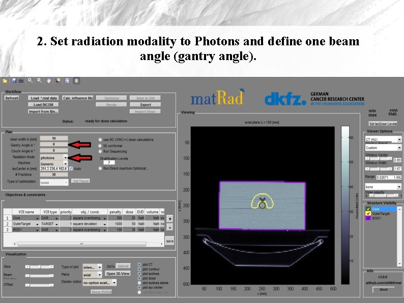2. Set radiation modality to Photons and define one beam angle (gantry angle). 