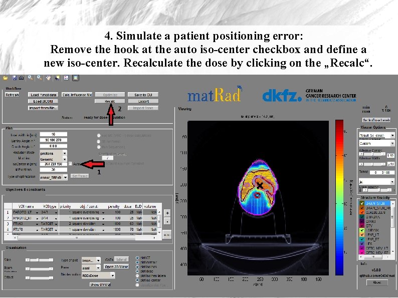 4. Simulate a patient positioning error: Remove the hook at the auto iso-center checkbox