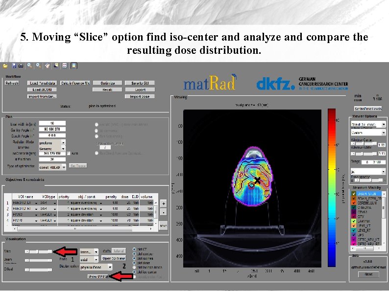 5. Moving “Slice” option find iso-center and analyze and compare the resulting dose distribution.