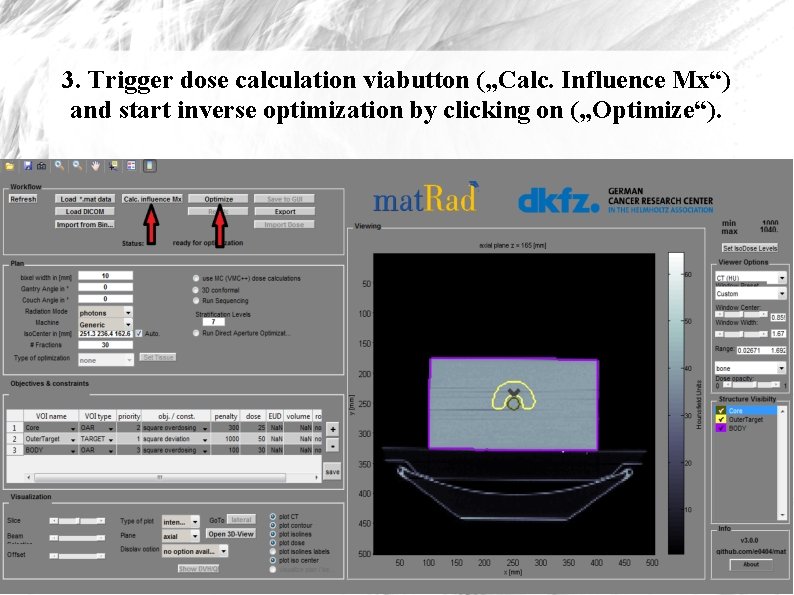 3. Trigger dose calculation viabutton („Calc. Influence Mx“) and start inverse optimization by clicking