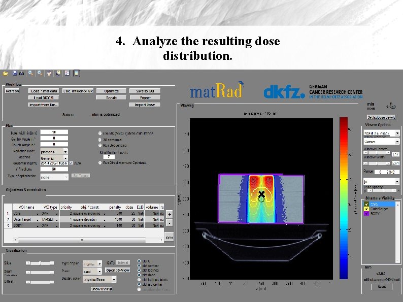 4. Analyze the resulting dose distribution. 
