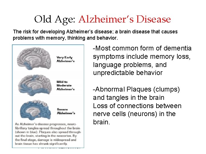 Old Age: Alzheimer’s Disease The risk for developing Alzheimer’s disease; a brain disease that