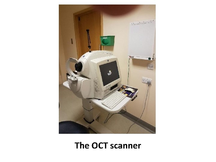The OCT scanner 