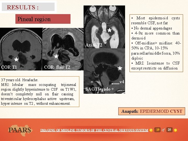 RESULTS : • Most epidermoid cysts resemble CSF, not fat • No dermal appendages