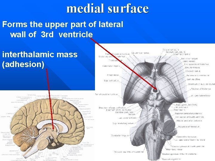 medial surface Forms the upper part of lateral wall of 3 rd ventricle interthalamic