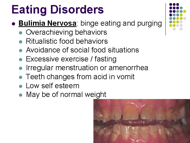 Eating Disorders l Bulimia Nervosa: binge eating and purging l Overachieving behaviors l Ritualistic