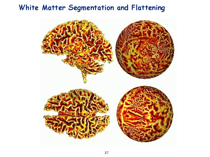 White Matter Segmentation and Flattening 27 