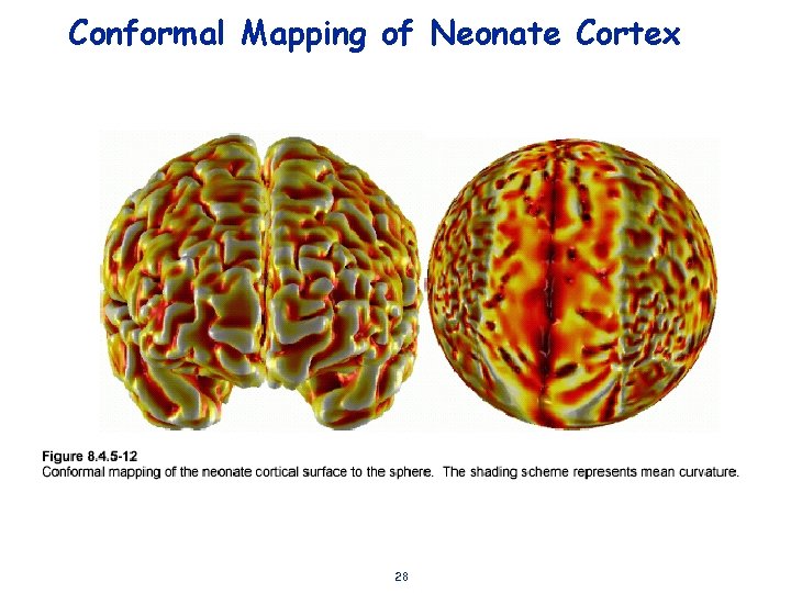 Conformal Mapping of Neonate Cortex 28 