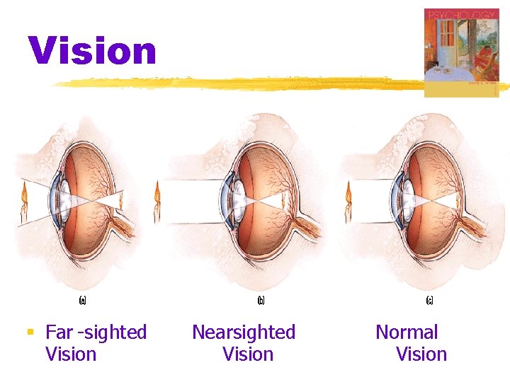 Vision § Far -sighted Vision Nearsighted Vision Normal Vision 