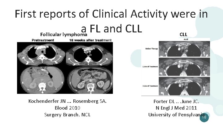 First reports of Clinical Activity were in a FL and CLL Follicular lymphoma CLL