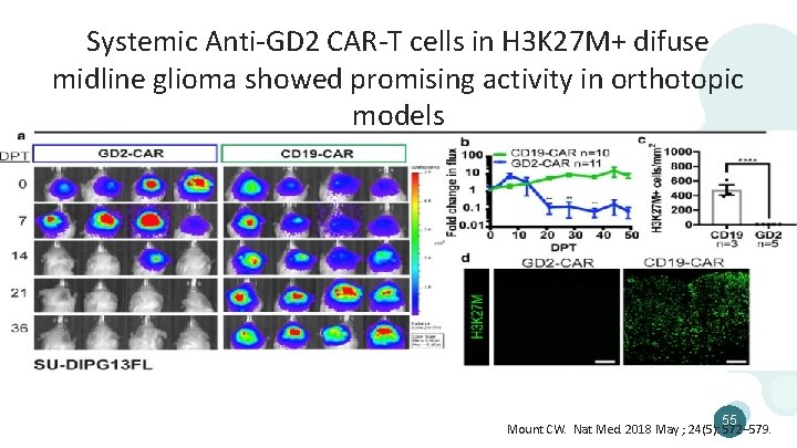 Systemic Anti-GD 2 CAR-T cells in H 3 K 27 M+ difuse midline glioma