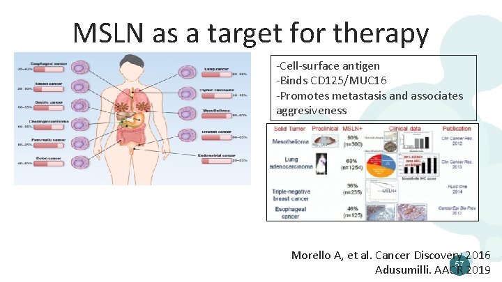 MSLN as a target for therapy -Cell-surface antigen -Binds CD 125/MUC 16 -Promotes metastasis
