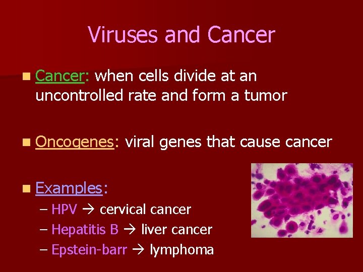 Viruses and Cancer n Cancer: when cells divide at an uncontrolled rate and form