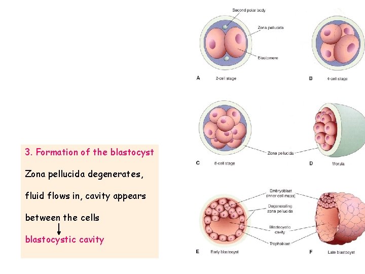 3. Formation of the blastocyst Zona pellucida degenerates, fluid flows in, cavity appears between