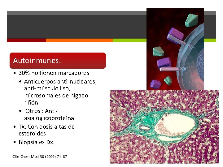 Autoinmunes: • 30% no tienen marcadores • Anticuerpos anti-nucleares, anti-músculo liso, microsomales de hígado