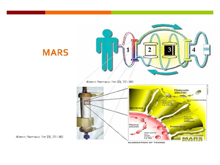 MARS 