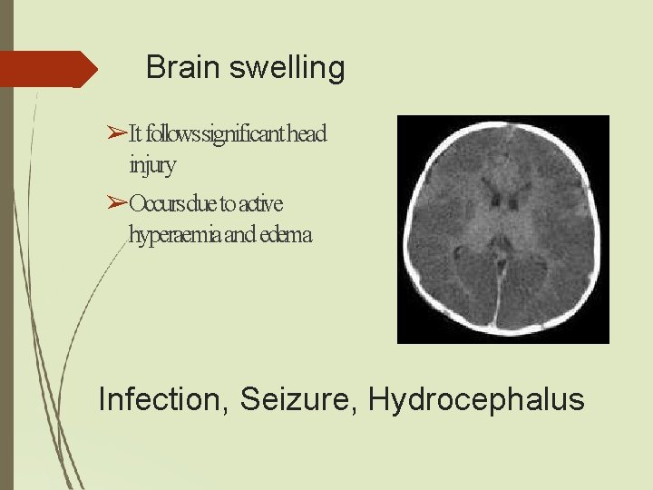 Brain swelling ➢It followssignificant head injury ➢Occursdue to active hyperaemia and edema Infection, Seizure, Brain swelling ➢It followssignificant head injury ➢Occursdue to active hyperaemia and edema Infection, Seizure,