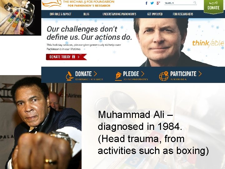 Muhammad Ali – diagnosed in 1984. (Head trauma, from activities such as boxing) 