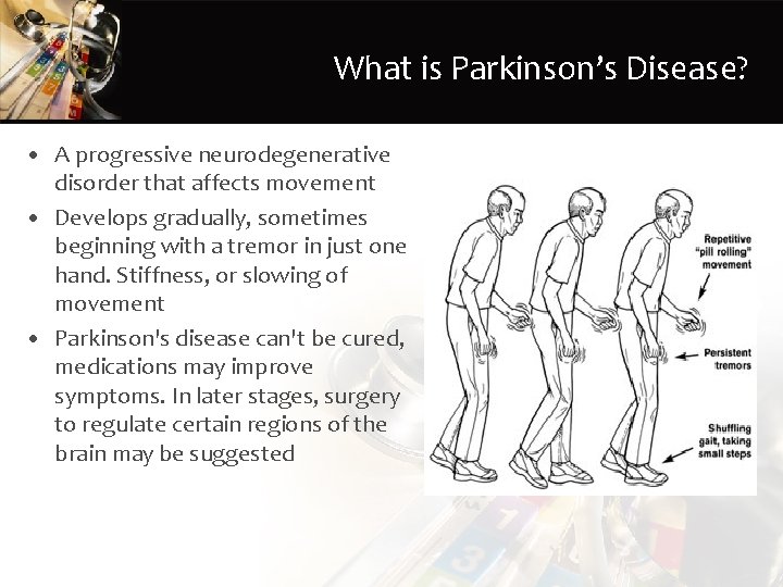 What is Parkinson’s Disease? • A progressive neurodegenerative disorder that affects movement • Develops