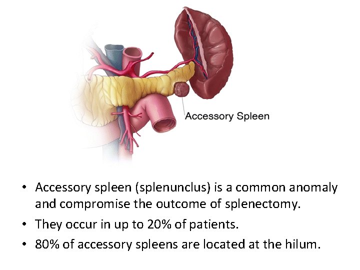  • Accessory spleen (splenunclus) is a common anomaly and compromise the outcome of